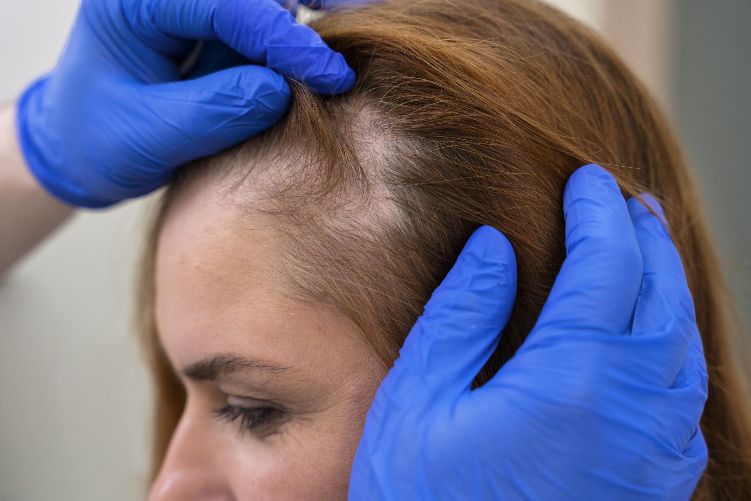 Hair restoration and hair reduction treatments
